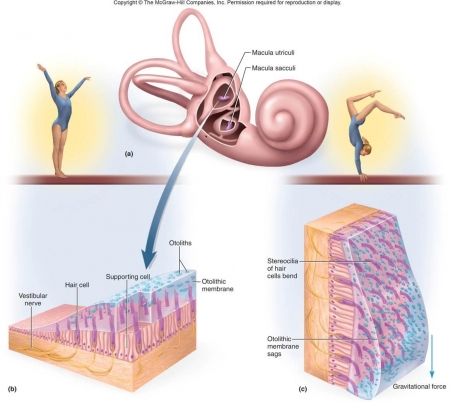 Vertigo Disease : Case Presentation image