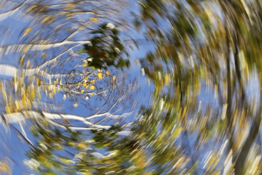 Dizziness